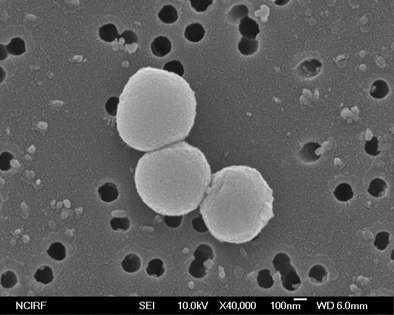 [Thermococcus onnurineus NA1]